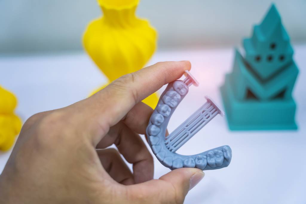 impression 3D en dentisterie 